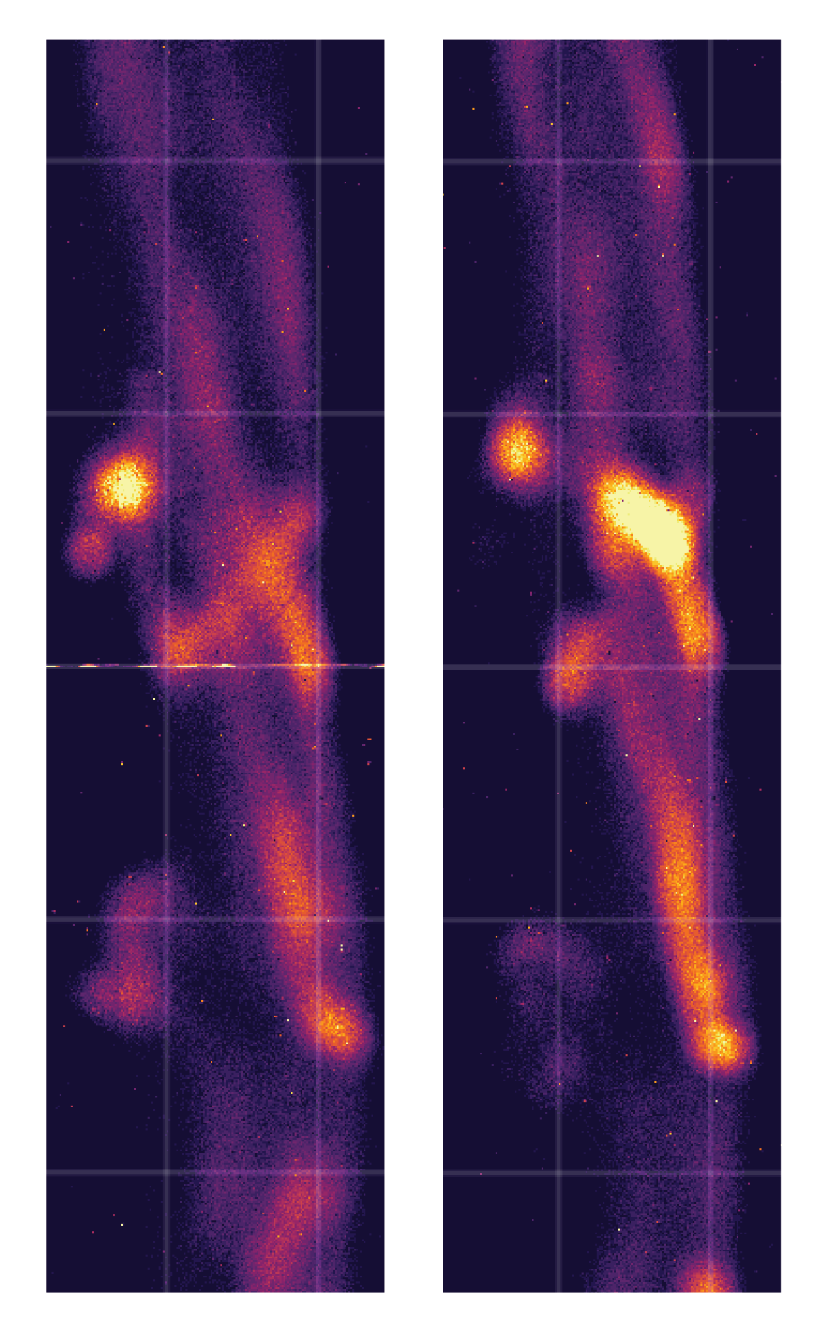 Two images of x-ray emission that correspond to plasmoids created in a magnetic reconnection layer.