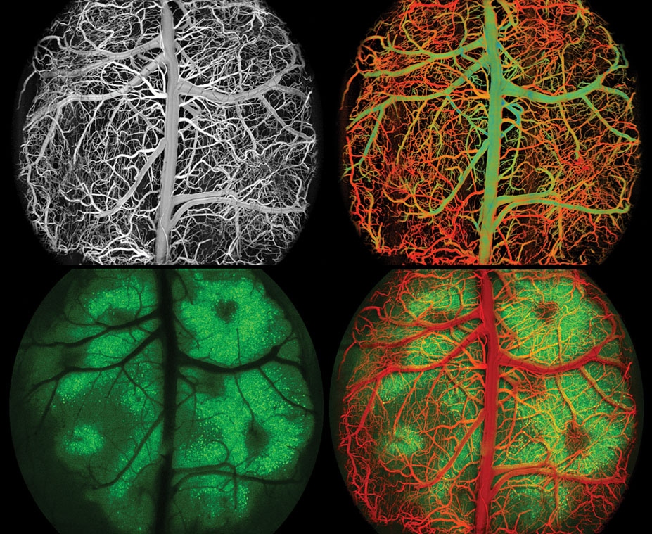 Four micrographs of a mouse's brain.