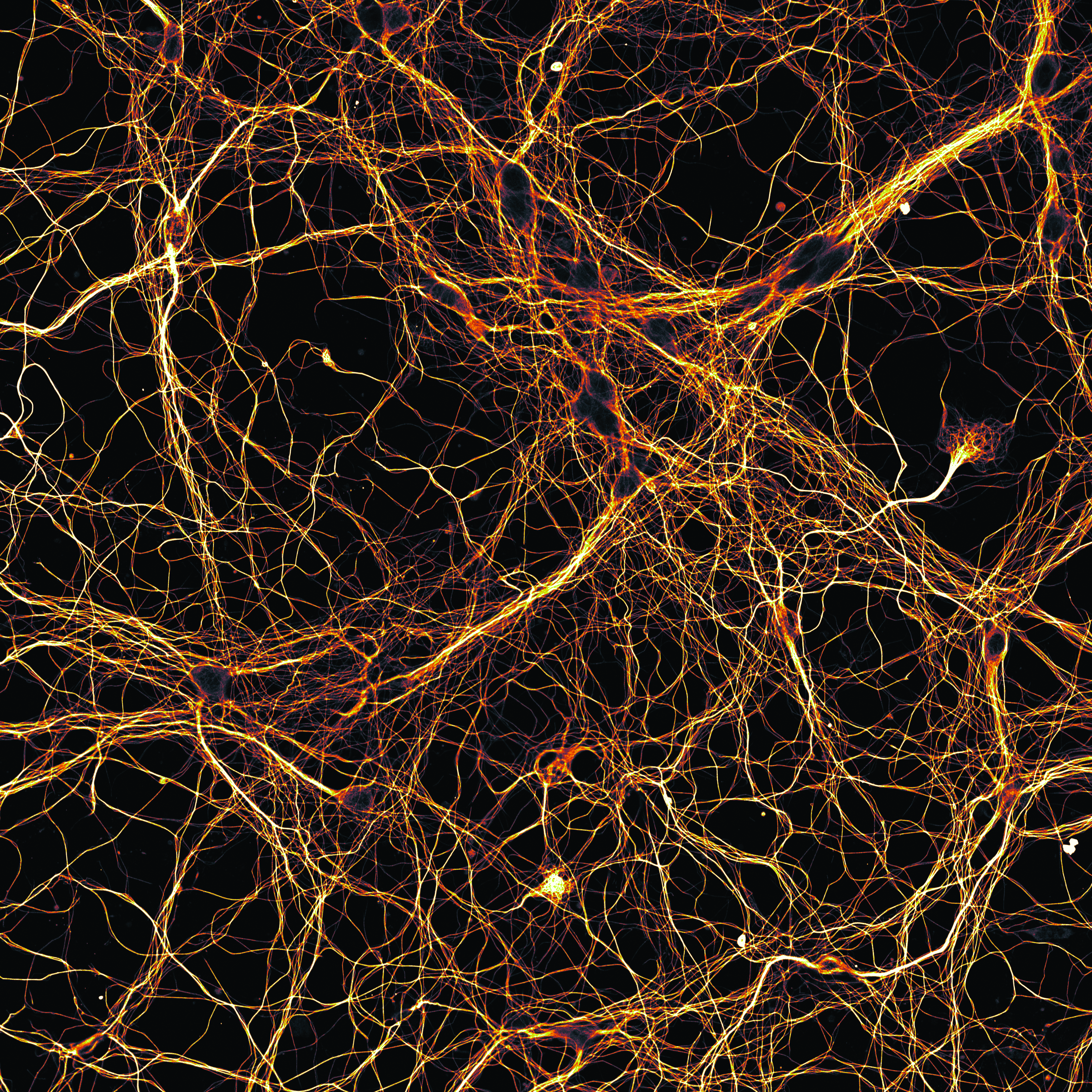 A dense thicket of neurons against a black background.