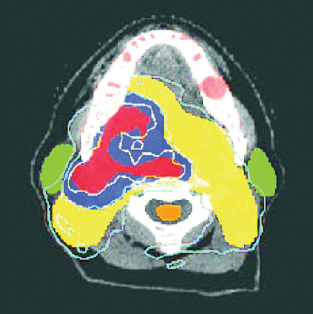 PTO.v55.i9.38_1.f6.jpg