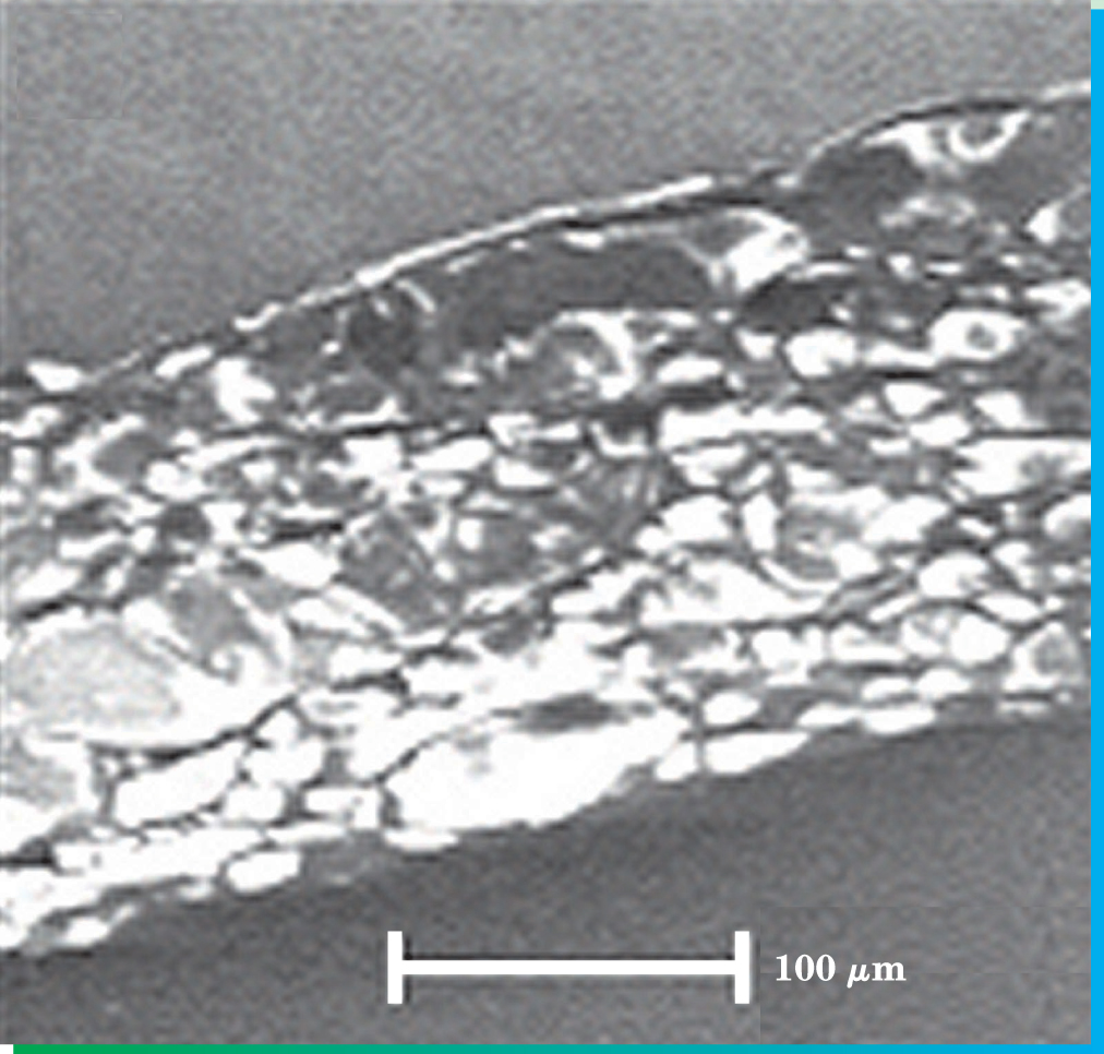 PTO.v57.i2.37_1.f2.jpg