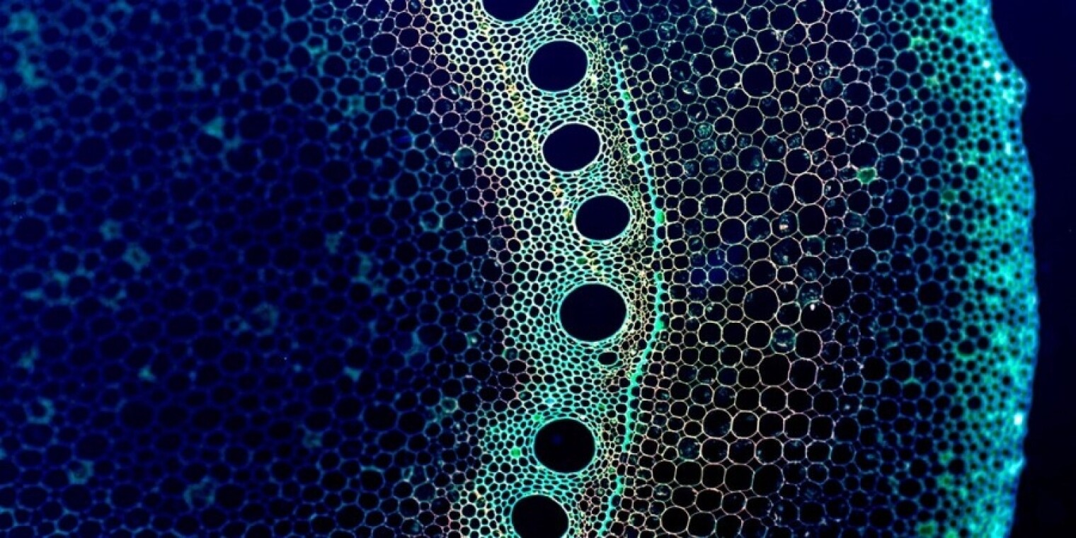 The National Academies is holding a virtual event this week to collect input for its decadal survey of the “physics of living systems,” making up for a town hall event that was to be held at the APS March meeting. Pictured is a cross section of a plant st
