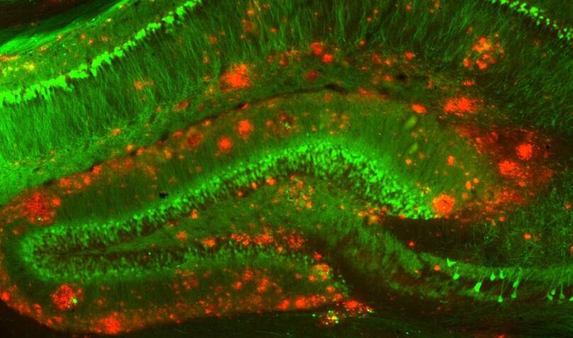 Alzheimer's Drug Trials Keep Failing -- It May Be Because We Don't Understand the Disease lead image