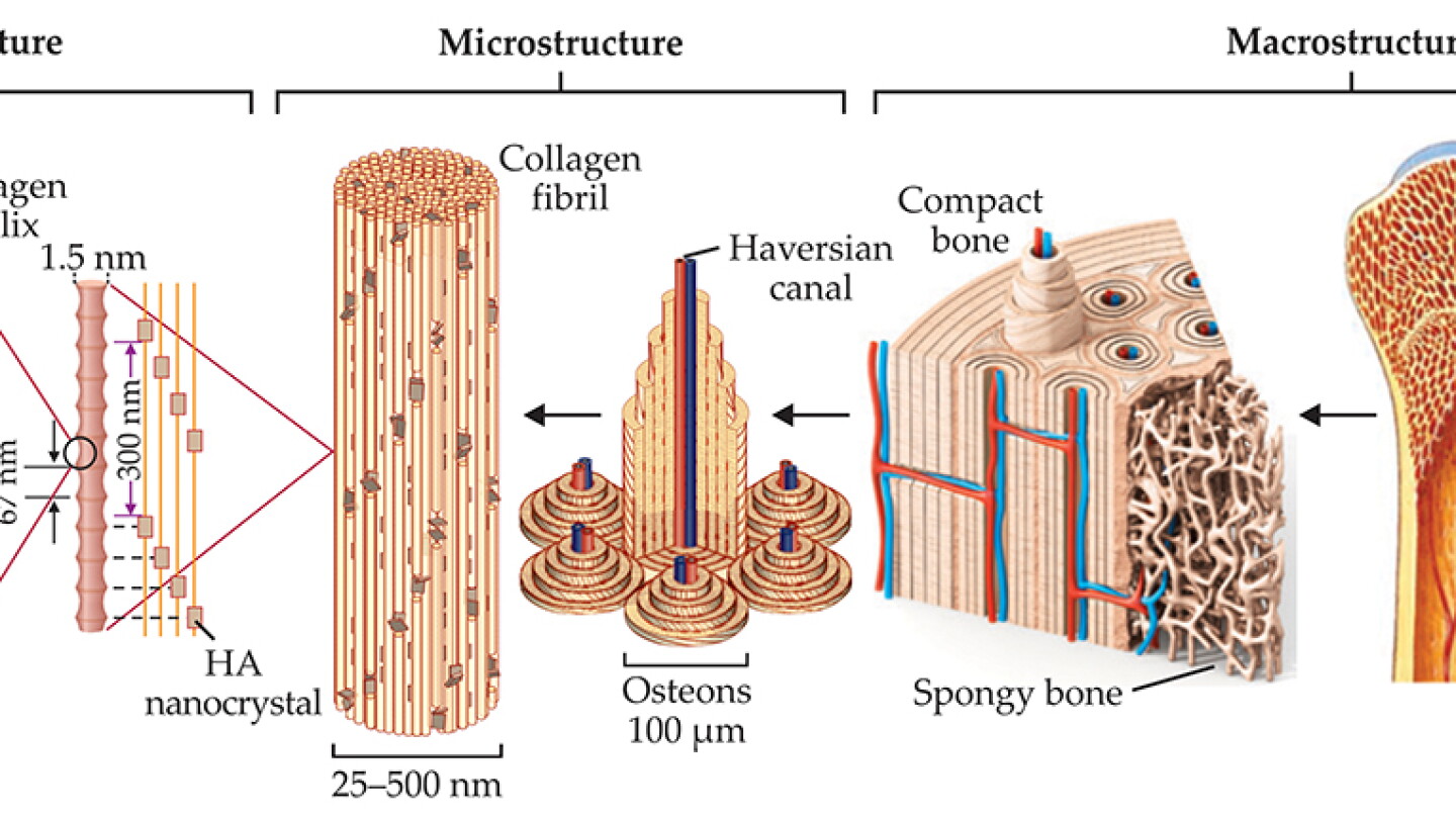 Bone, implants, and their interfaces - Physics Today