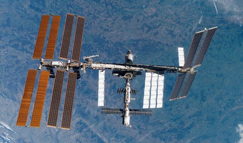 Long Trips to Space Linked to Possible Brain Damage lead image
