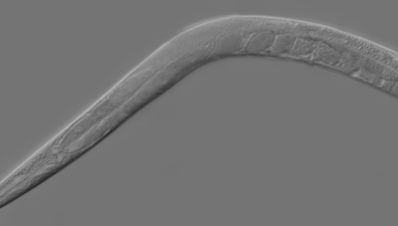 Limits on the Volume of a Cell's Nucleus disp image