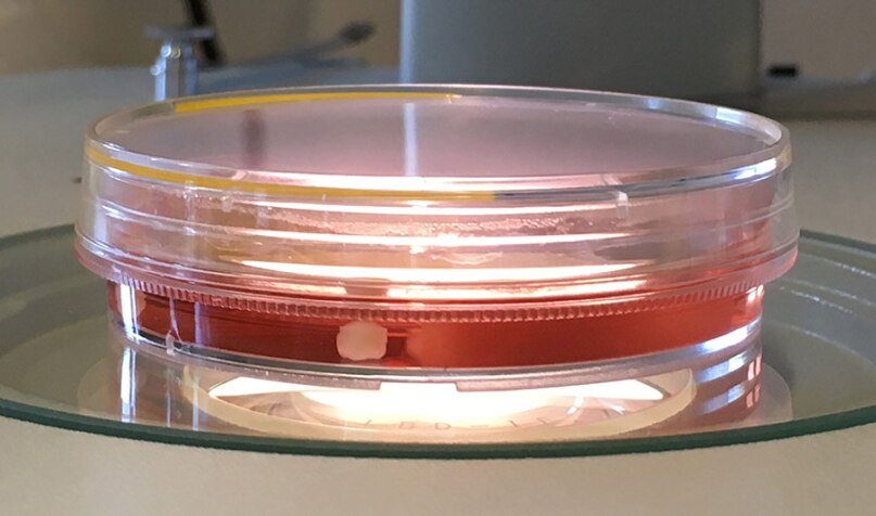 Lab-Grown Mini-brains Show How Humans Differ From Monkeys and Chimpanzees lead image