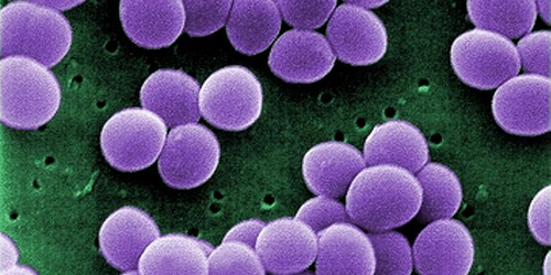 Reducing Persistence of Antibiotic Resistance disp image